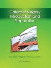 book Cataract Surgery : Introduction and Preparation