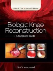 book Biologic Knee Reconstruction : A Surgeon's Guide