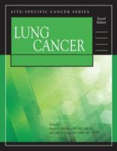 book Lung Cancer