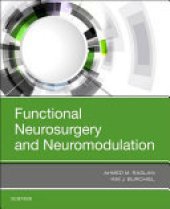 book Functional Neurosurgery and Neuromodulation