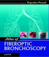 book Atlas of Fiberoptic Bronchoscopy