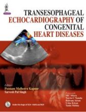 book Transesophageal Echocardiography of Congenital Heart Diseases