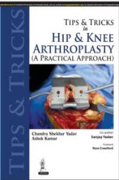 book Tips and Tricks in Hip and Knee Arthroplasty