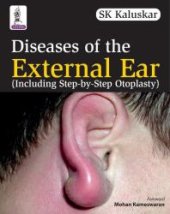 book Diseases of the External Ear (Including Step-By-Step Otoplasty)