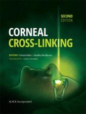 book Corneal Cross-Linking, Second Edition