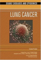 book Lung Cancer 