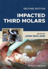 book Impacted Third Molars [Team-IRA]