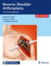 book Reverse Shoulder Arthroplasty : A Practical Approach