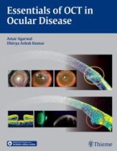 book Essentials of OCT in Ocular Disease