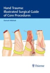 book Hand Trauma: Illustrated Surgical Guide of Core Procedures