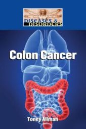 book Colon Cancer