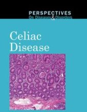 book Celiac Disease