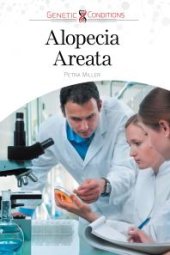 book Alopecia Areata