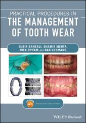 book Practical Procedures in the Management of Tooth Wear