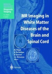 book MR Imaging in White Matter Diseases of the Brain and Spinal Cord 