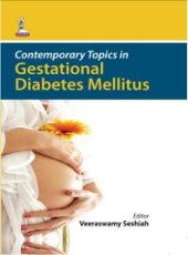 book Contemporary Topics in Gestational Diabetes Mellitus