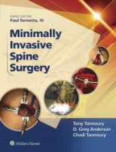 book Minimally Invasive Spine Surgery