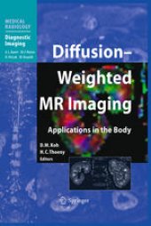 book Diffusion-Weighted MR Imaging