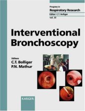 book Interventional Bronchoscopy 