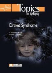 book Dravet Syndrome