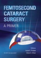 book Femtosecond Cataract Surgery: A Primer