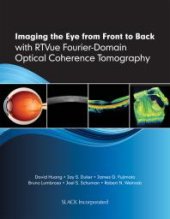 book Imaging the Eye from Front to Back with RTVue Fourier-Domain Optical Coherence Tomography