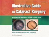 book Illustrative Guide to Cataract Surgery: A Step-By-Step Approach to Refining Surgical Skills