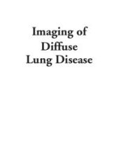 book Imaging of Diffuse Lung Disease