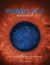 book Phakic IOLs: State of the Art