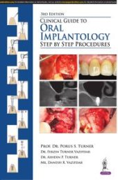 book Clinical Guide to Oral Implantology: Step by Step Procedures