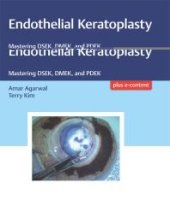 book Endothelial Keratoplasty: Mastering DSEK, DMEK, and PDEK