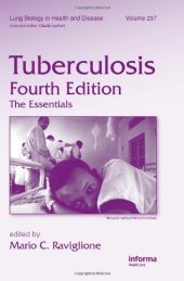 book Tuberculosis: The Essentials, Fourth Edition 