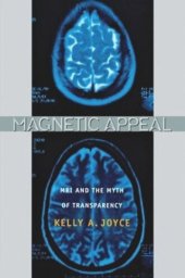 book Magnetic Appeal: MRI and the Myth of Transparency