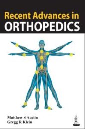 book Recent Advances in Orthopedics