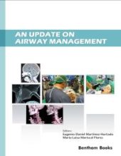 book An Update on Airway Management