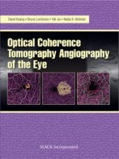 book Optical Coherence Tomography Angiography of the Eye