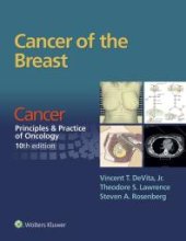 book Cancer of the Breast: From Cancer: Principles and Practice of Oncology, 10th Edition