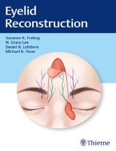 book Eyelid Reconstruction