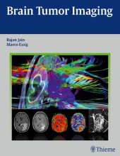 book Brain Tumor Imaging