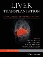 book Liver Transplantation: Clinical Assessment and Management