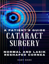 book A Patient's Guide to Cataract Surgery: Normal and LASIK Reshaped Cornea