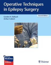 book Operative Techniques in Epilepsy Surgery