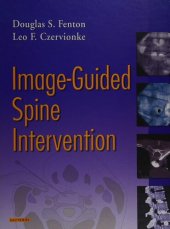 book Image-Guided Spine Intervention