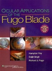 book Ocular Applications of the Fugo Blade