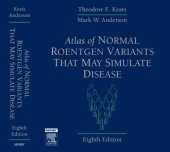 book Atlas of Normal Roentgen Variants That May Simulate Disease