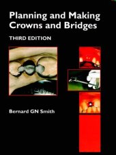 book Planning and Making Crowns and Bridges 3rd Edition