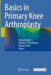 book Basics in Primary Knee Arthroplasty