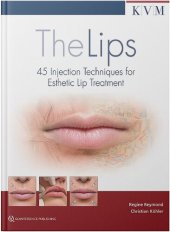 book The Lips: 45 Injection Techniques for Esthetic Lip Treatment