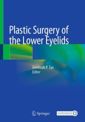 book Plastic Surgery of the Lower Eyelids