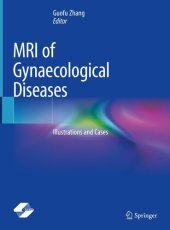 book MRI of Gynaecological Diseases: Illustrations and Cases